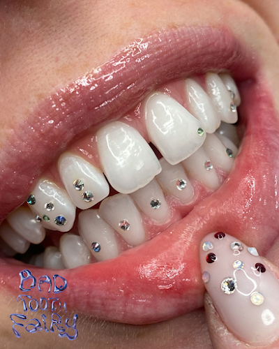 Bad Tooth Fairy – Strass dentaires à Nantes